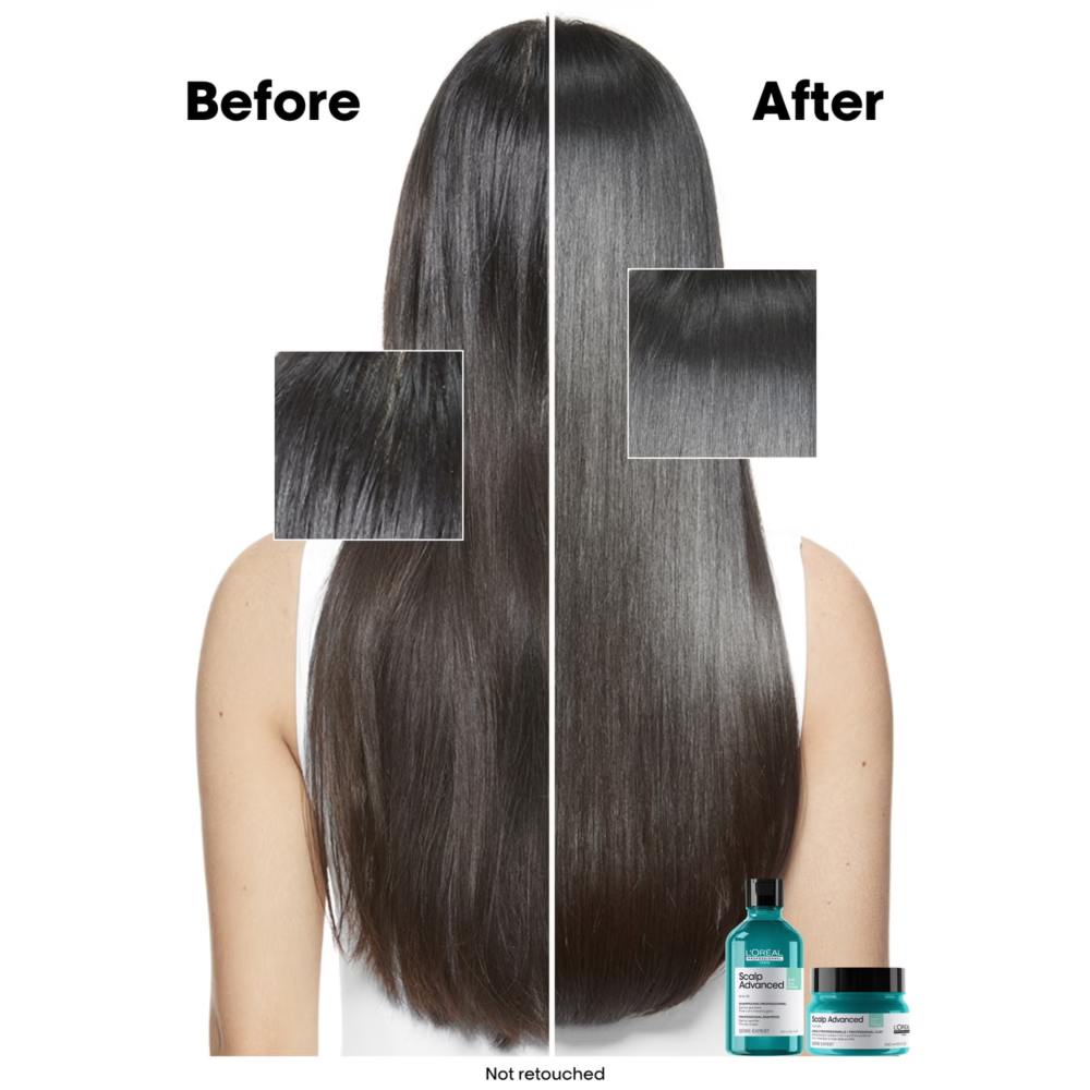 LOREAL PRO SERIE EXPERT SCALP ADVANCE ANTI OILY MASK 250 ML R I22 - Image 5