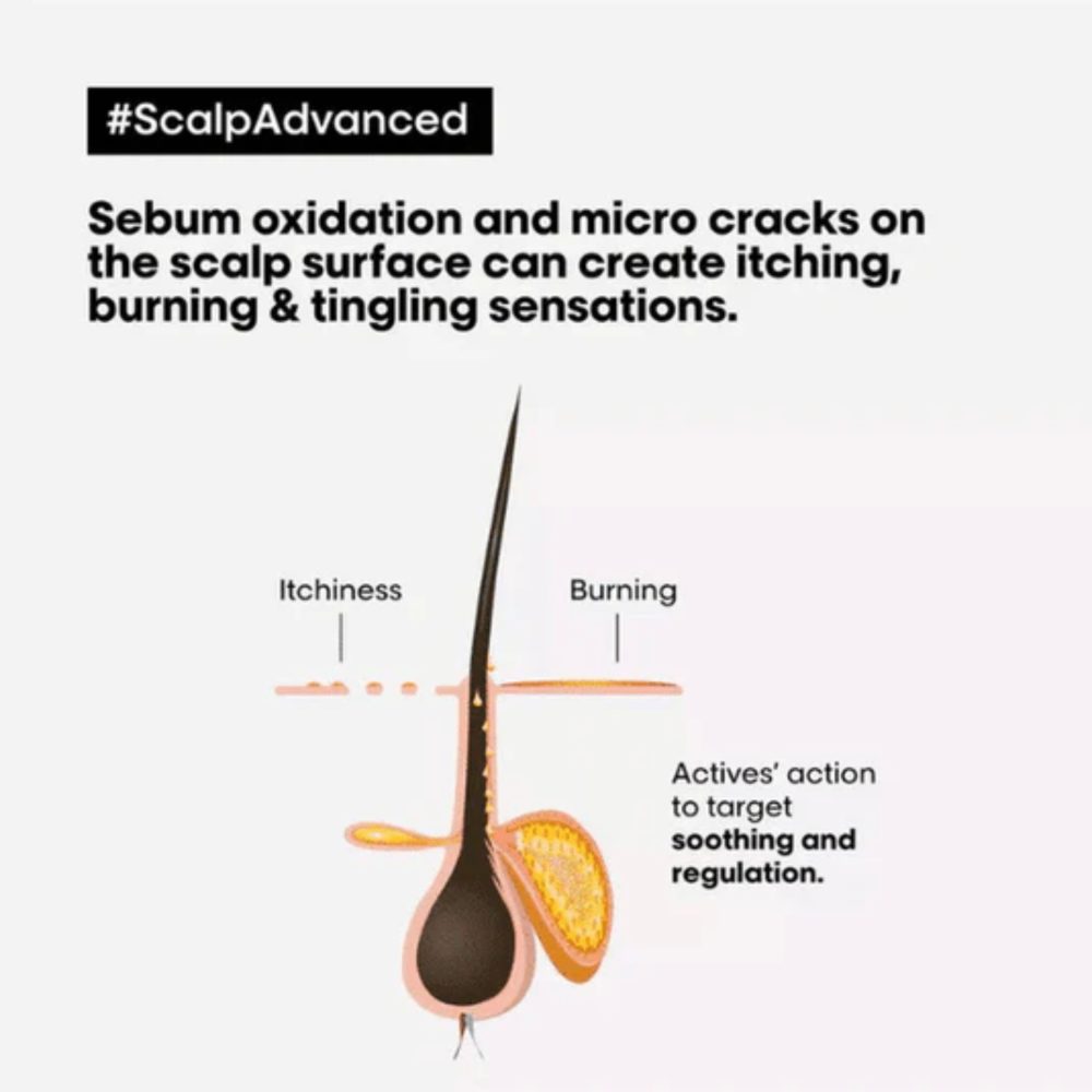 L’Oréal Serie Expert Scalp Advanced Anti-Discomfort Intense Soother Treatment - Image 3